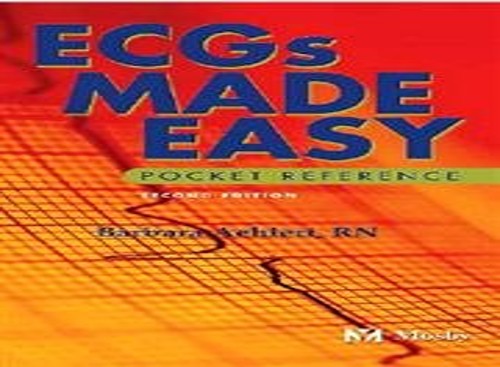 ECGs Made Easy by Barbara Aehlert ISBN 9780323014335