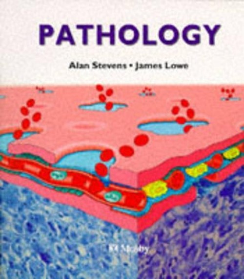 Pathology by Alan Stevens ISBN 9780397447640