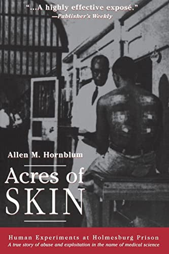 Acres of Skin by Allen M Hornblum ISBN 9780415923361