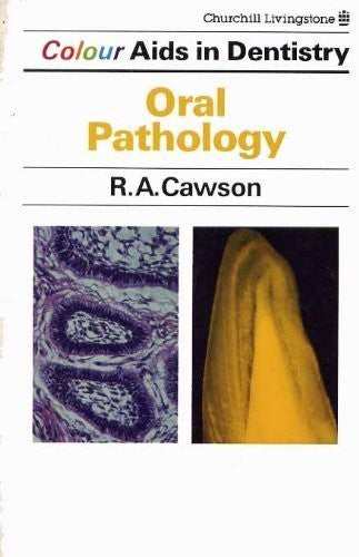 Oral Pathology by Roderick A Cawson ISBN 9780443031427