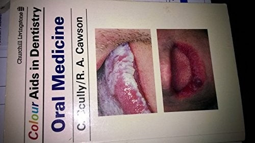 Colour Aids in Oral Medicine by Roderick A Cawson ISBN 9780443038754
