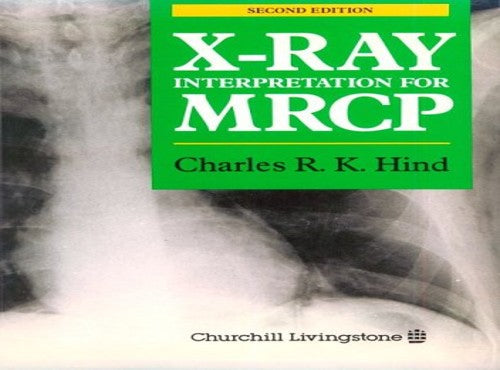 X-Ray Interpretaion for MRCP by Charles Rk Hind ISBN 9780443045516