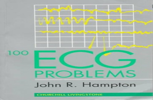 100 ECG Problems by John R Hampton ISBN 9780443056789