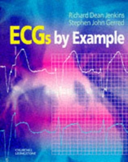 ECG's by Example by Stephen John Gerred ISBN 9780443056970