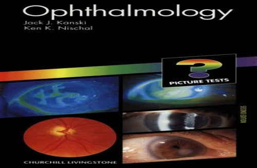 Picture Tests in Ophthalmology by Jack J Kanski ISBN 9780443060373