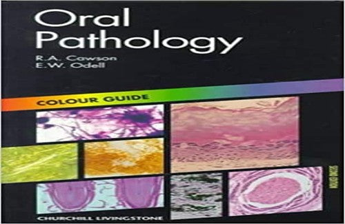 Oral Pathology by Roderick A Cawson ISBN 9780443061714