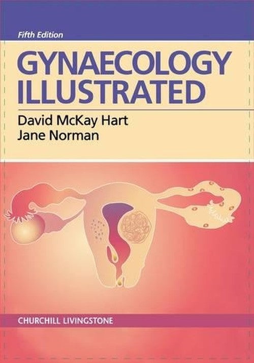 Gynaecology Illustrated by David Mckay Hart ISBN 9780443061981
