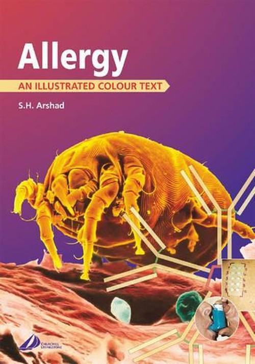 Allergy by S Hasan Arshad ISBN 9780443062711