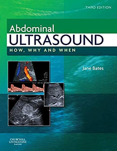 Abdominal Ultrasound by Jane A Smith Mphil Dmu Dcr ISBN 9780443069192