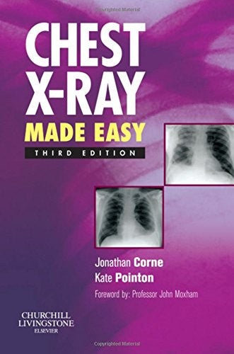 Chest X-Ray Made Easy by Jonathan Corne ISBN 9780443069222