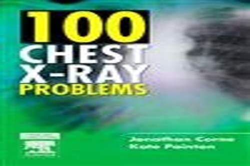 100 Chest X-Ray Problems by Jonathan Corne Ma Mb Bs Frcp ISBN 9780443070129