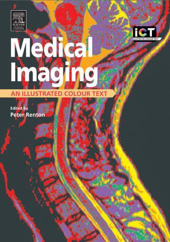 Medical Imaging by Peter Renton ISBN 9780443070303