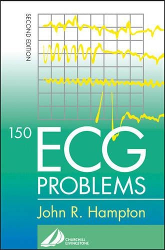 150 ECG Problems by John R Hampton ISBN 9780443072482