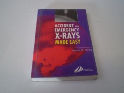 Accident and Emergency X-Rays Made Easy by James D Begg Mb Bs Frcr ISBN 9780443073243