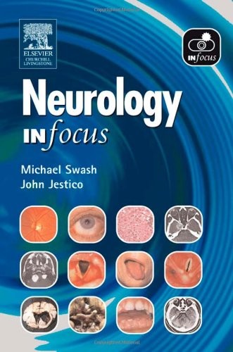 Neurology in Focus by Michael Swash ISBN 9780443101243
