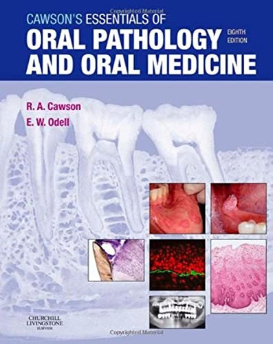 Cawson's Essentials of Oral Pathology and Oral Medicine by Roderick A Cawson ISBN 9780443101250