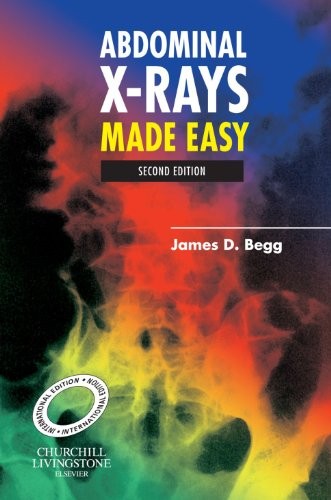 Abdominal X-Rays Made Easy, International Edition by James D Begg Mb Bs Frcr ISBN 9780443102561