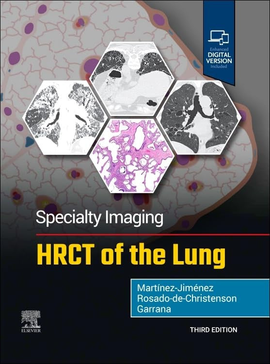 Specialty Imaging: HRCT of the Lung by Sherief Garrana ISBN 9780443286360