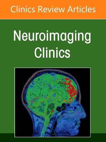 Management and Treatment of Cerebral Aneurysms, An Issue of Neuroimaging Clinics of North America by Daniel Sahlein Md ISBN 9780443343087