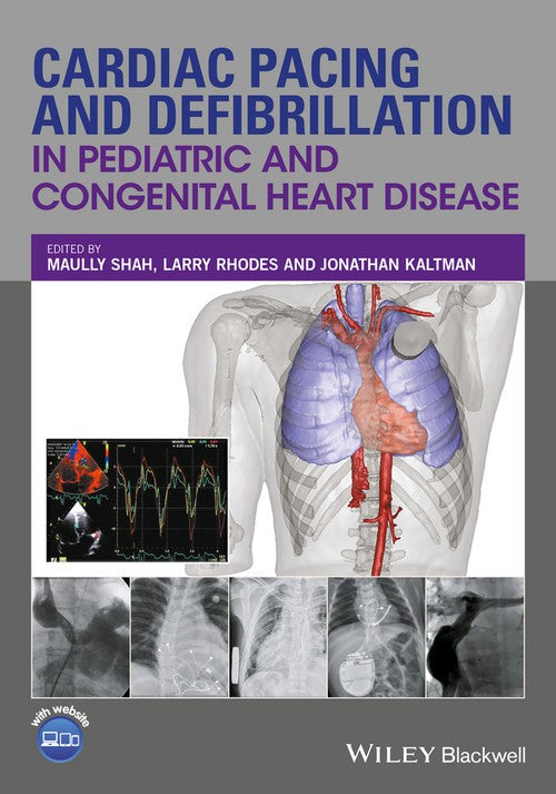 Cardiac Pacing and Defibrillation in Pediatric and Congenital Heart Disease by Maully Shah ISBN 9780470671092