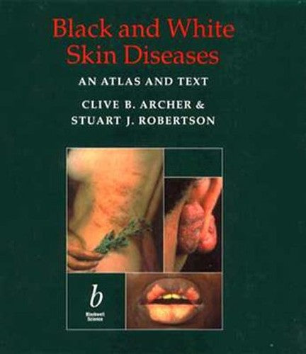 Black and White Skin Diseases by Clive B Archer ISBN 9780632025299