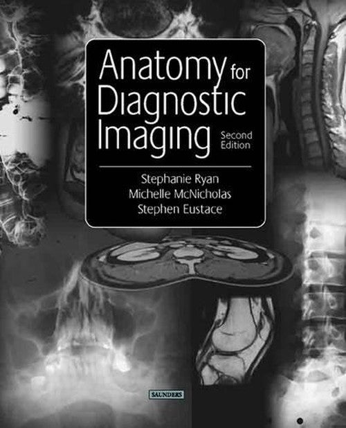 Anatomy for Diagnostic Imaging by Stephanie Ryan ISBN 9780702026201
