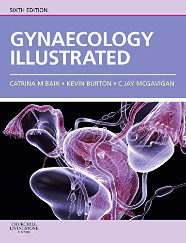 Gynaecology Illustrated by Catrina Bain Mbchb Mrcog ISBN 9780702030673