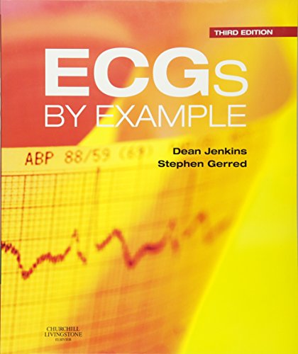 ECGs by Example by Dean Jenkins Mb Bch Frcp Dipmeded ISBN 9780702042287