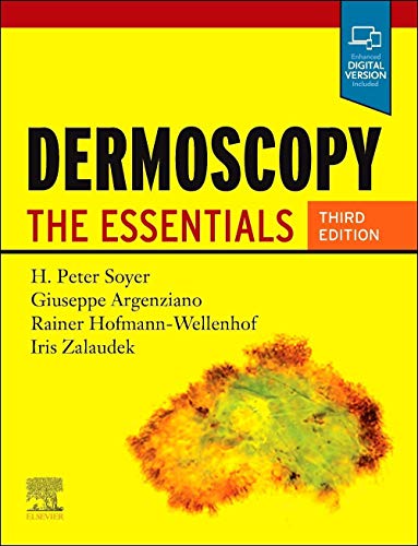 Dermoscopy by H Peter Soyer Md Facd ISBN 9780702068829