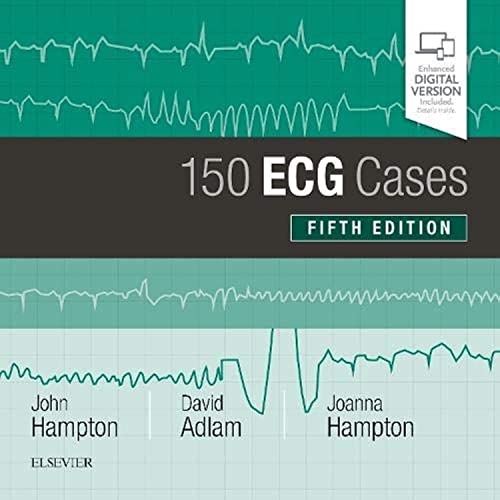 150 ECG Cases by John Hampton Dm Ma Dphil Frcp Ffpm Fesc ISBN 9780702074585