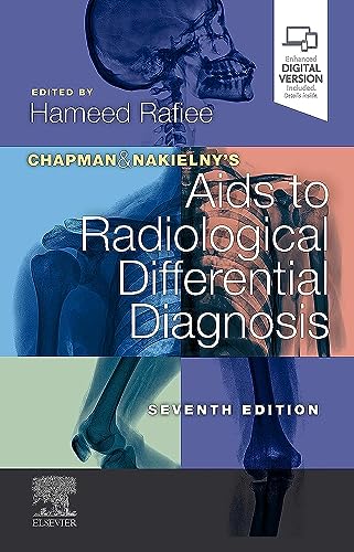 Chapman & Nakielny's Aids to Radiological Differential Diagnosis by Hameed Rafiee Mbbs Frcr ISBN 9780702075391