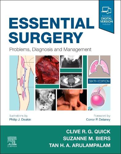 Essential Surgery by Philip J Deakin Bsc Mbchb 9780702076312