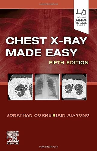 Chest X-Ray Made Easy by Jonathan Corne Ma Mb Bs Frcp ISBN 9780702082344