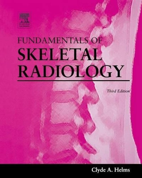 Fundamentals of Skeletal Radiology by Clyde Helms ISBN 9780721605708