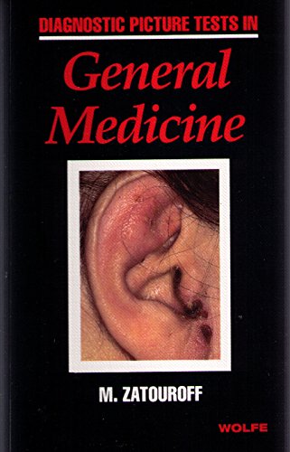 Diagnostic Picture Tests in General Medicine by Michael Zatouroff ISBN 9780723409427