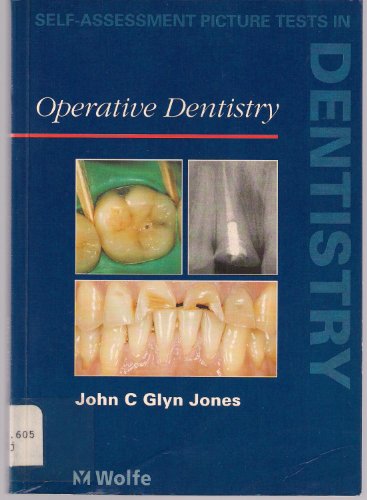 Operative Dentistry by John Glyn Jones ISBN 9780723419471
