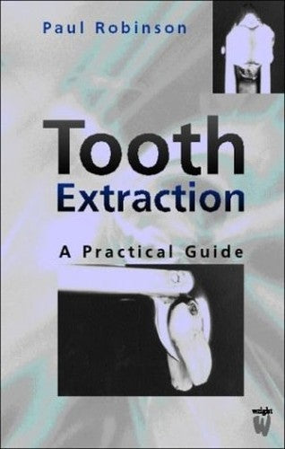 Tooth Extraction by Paul Robinson ISBN 9780723610717