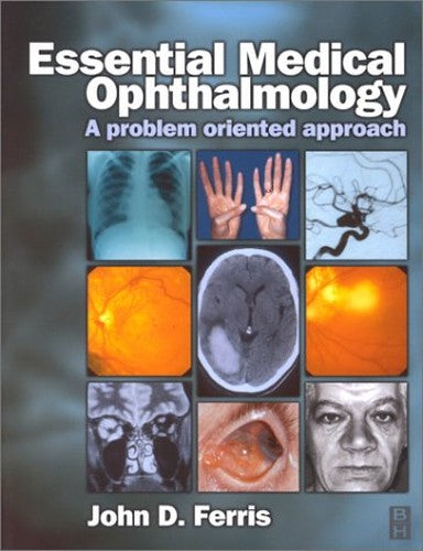 Essential Medical Ophthalmology by John D Ferris Frcophth ISBN 9780750649377