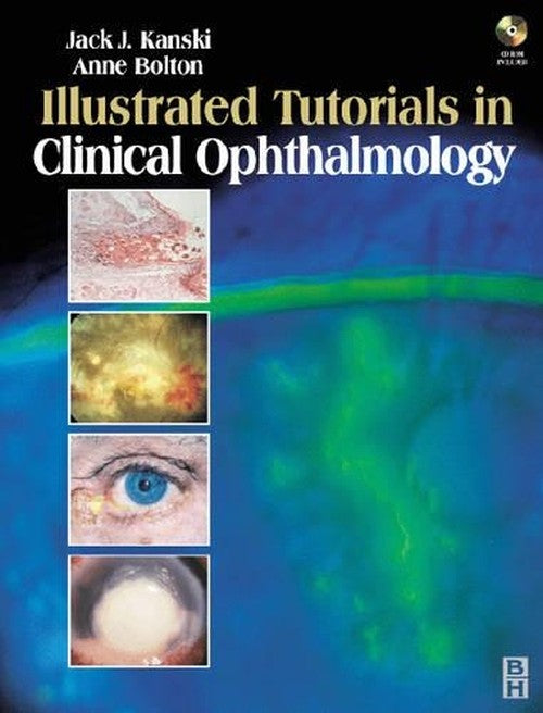 Illustrated Tutorials in Clinical Ophthalmology with CD-ROM by Jack J Kanski Md Ms Frcs Frcophth ISBN 9780750652728