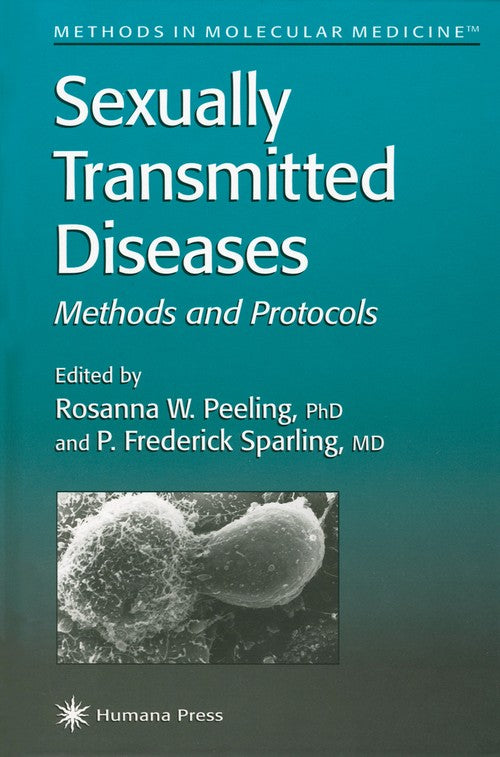 Sexually Transmitted Diseases by Rosanna Peeling ISBN 9780896035355
