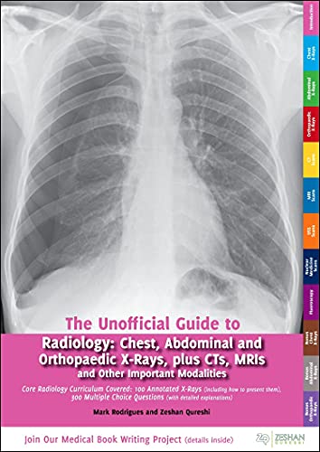 Unofficial Guide to Radiology by Mark A Rodrigues ISBN 9780957149946