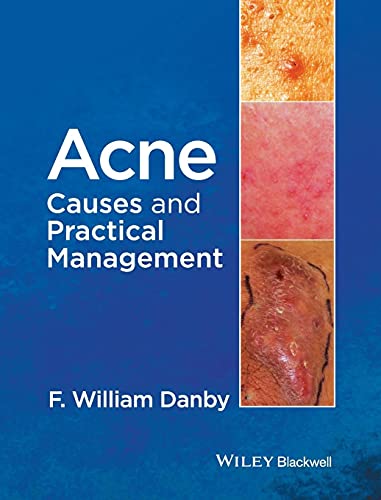 Acne by F William Danby ISBN 9781118232774