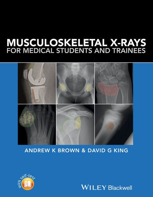 Musculoskeletal X-Rays for Medical Students and Trainees by Andrew K Brown ISBN 9781118458730
