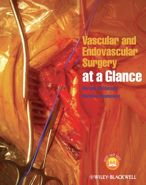 Vascular and Endovascular Surgery at a Glance by Morgan Mcmonagle ISBN 9781118496039