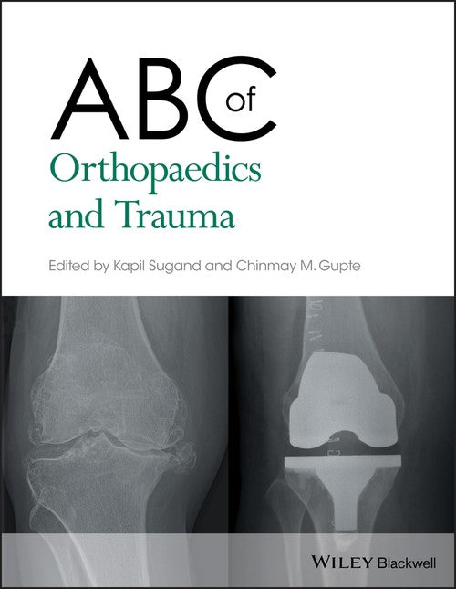 ABC of Orthopaedics and Trauma by Kapil Sugand ISBN 9781118561225