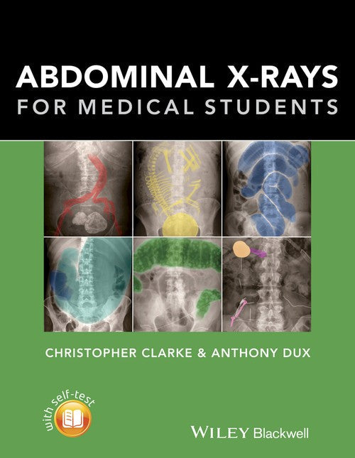 Abdominal X-rays for Medical Students by Christopher Clarke ISBN 9781118600559