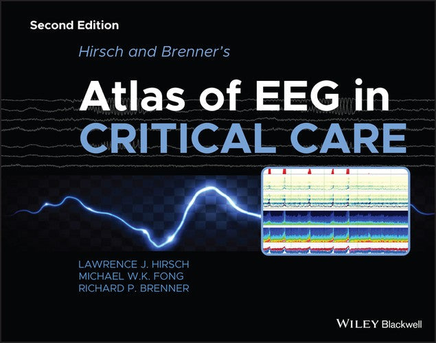 Hirsch and Brenner's Atlas of EEG in Critical Care by Lawrence J Hirsch ISBN 9781118752890