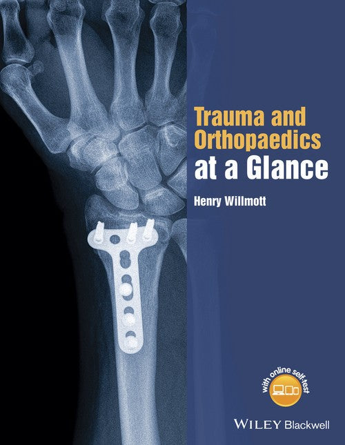 Trauma and Orthopaedics at a Glance by Henry Willmott ISBN 9781118802533