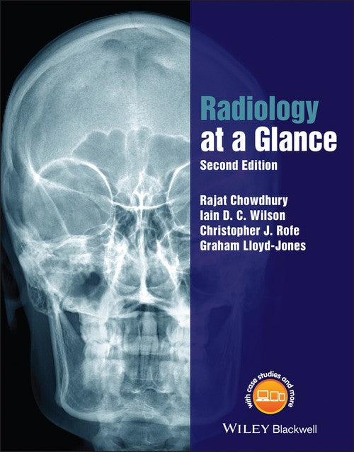 Radiology at a Glance by Rajat Chowdhury ISBN 9781118914779
