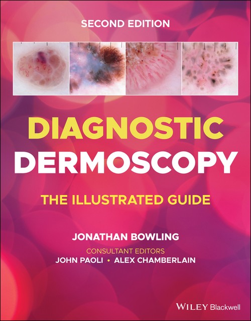 Diagnostic Dermoscopy by Jonathan Bowling ISBN 9781118930489